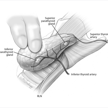 Hemithyroidectomy: A Safe Treatment Option for Thyroid Disorders